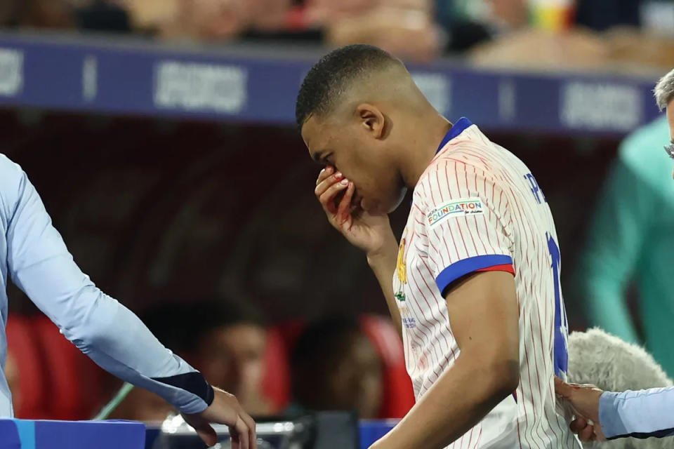 Kylian Mbappé’s Euros may be over according to former France medical chief