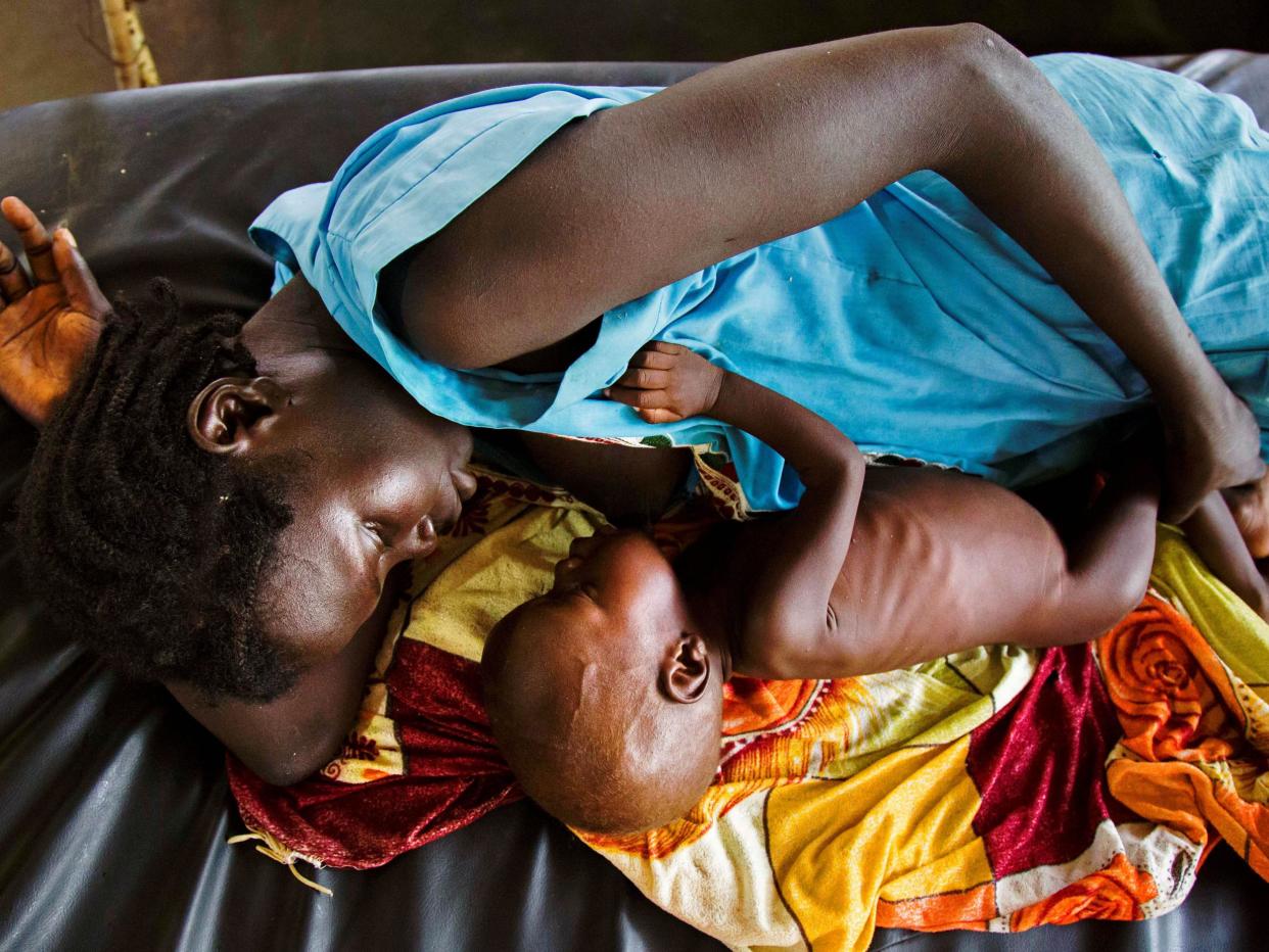 A mother breastfeeds her child, who is suffering from acute malnutrition, at a Doctors without Borders clinic in South Sudan: Getty Images