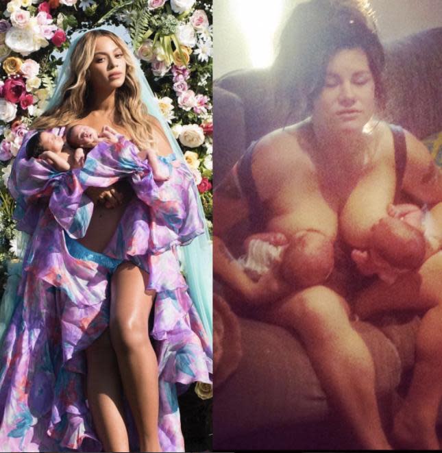 Women everywhere are spoofing Beyonce's twins photo