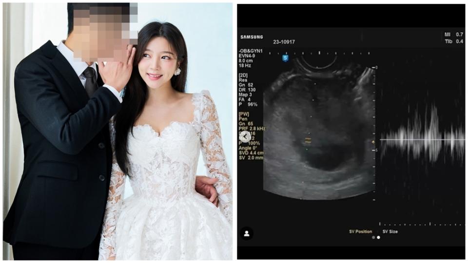 LABOUM成員廉海仁即將結婚。（圖／翻攝SportTVNews、海仁IG）