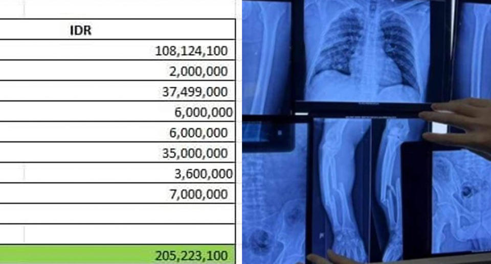 List of predicted medical bills. Medical bills and xray in Bali