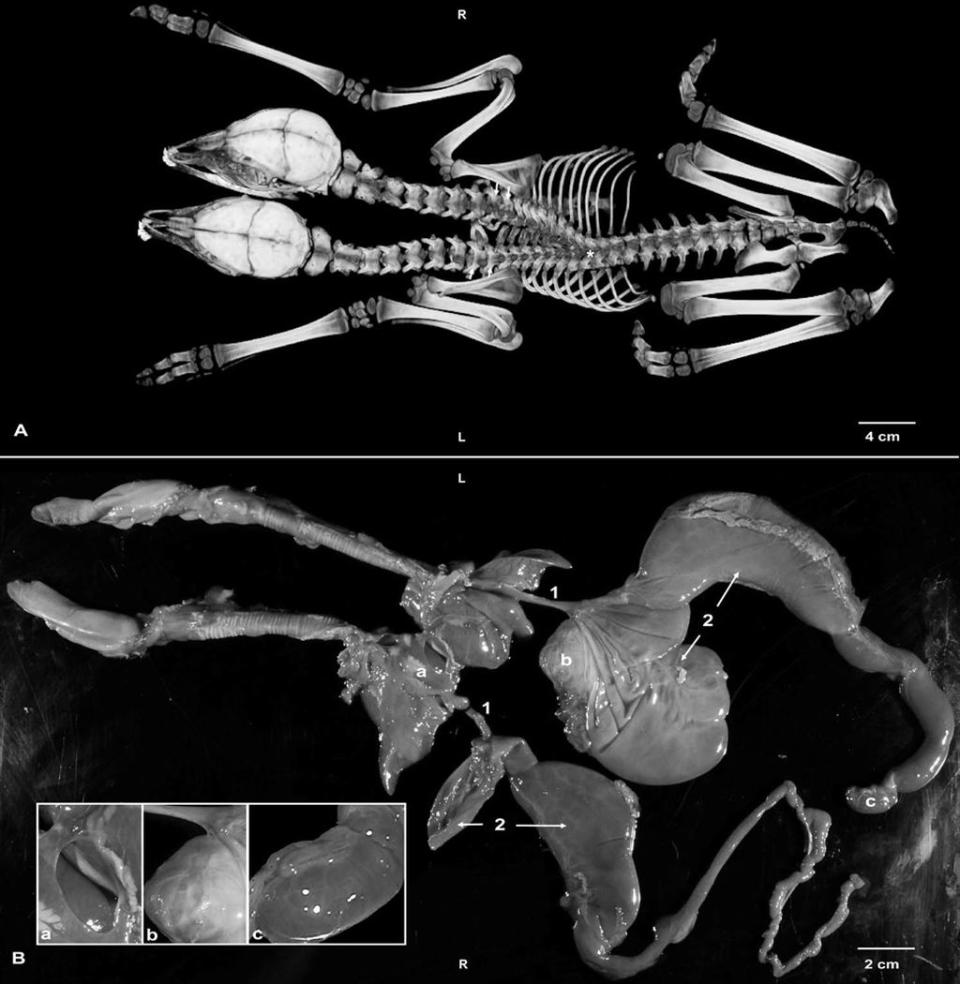 A CT scan of the fawns (A) revealed where their shared spinal column split into two individual necks and heads. A necropsy (B) showed twin sets of organs, including two hearts nestled in the same sac (a). <cite>Gino D’Angelo et al/University of Georgia</cite>