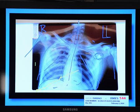 An x-ray is shown of the body of 17-year old Jordan Davis during testimony in the murder trial of Michael Dunn in Duval County Courthouse in Jacksonville, Florida on February 10, 2014. Dunn is accused of first degree murder in death of Davis after an altercation over loud rap music at a Florida gas station in November 2012. REUTERS/Bob Mack/Pool