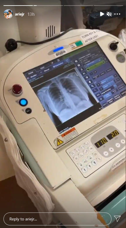 Lauren Burnham Luyendyk's chest X-ray (@ariejr/Instagram)