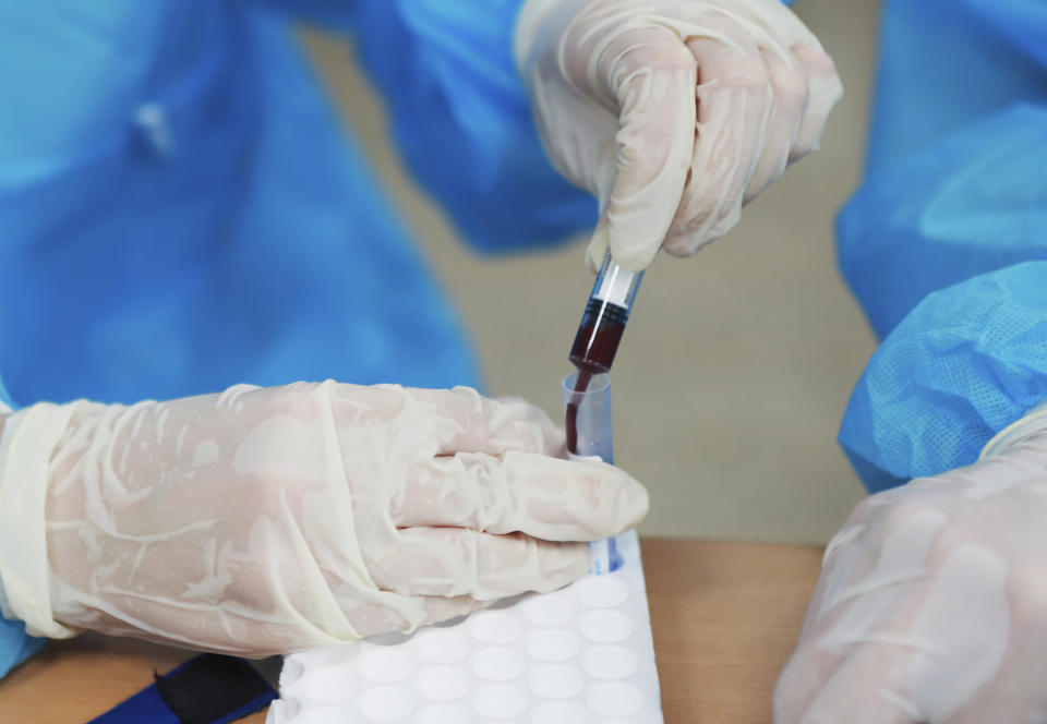 A health worker transfers drawn blood into a tube for a COVID-19 test in Hanoi, Vietnam, Friday, July 31, 2020. Vietnam reported on Friday the country's first death of a person with the coronavirus as it struggles with a renewed outbreak after 99 days without any cases. (AP Photo/Hau Dinh)
