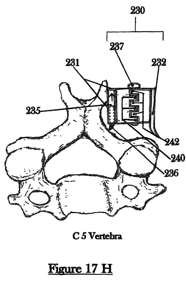 Image taken from the Cervi-Lok patent filing