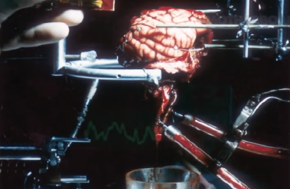 Cerebro de un macaco unido a una fuente de bombeo de sangre, uno de los experimentos previos del doctor White. (Imagen capturada de un vídeo del canal Motherboard en Youtube).