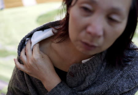 Cui Wenlan, 53, shows an injury on her shoulder during an interview at the house where her son lived in Zhangjiakou, China, November 21, 2015. REUTERS/Kim Kyung-Hoon