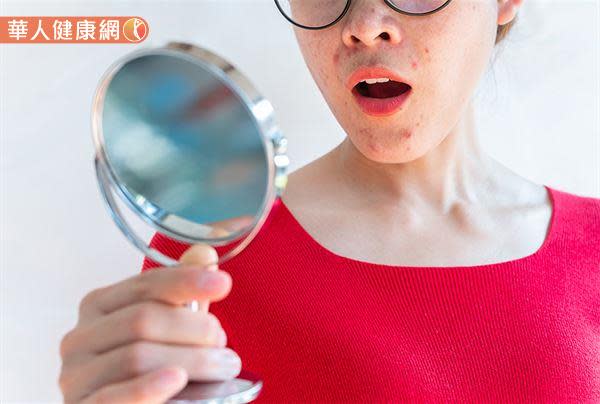 經前小腹悶脹、爆痘正常嗎？經痛無法避免？破解女性月經週期常見5大迷思