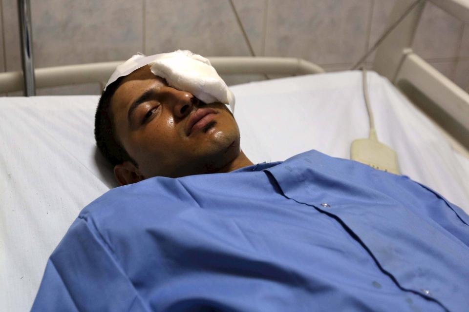 An injured man lies in a hospital after a bomb blast at a national security building in Shubra Al-Khaima on the outskirts of Cairo