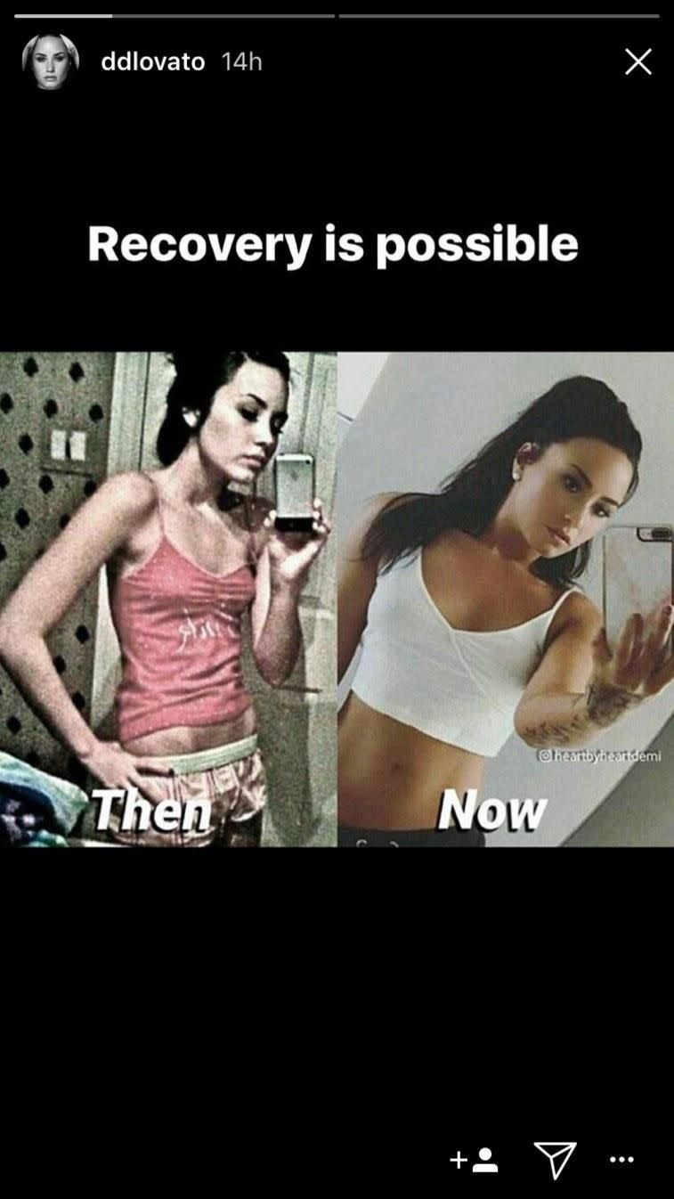 A fan created a before and after montage that Demi then shared. Source: Instagram