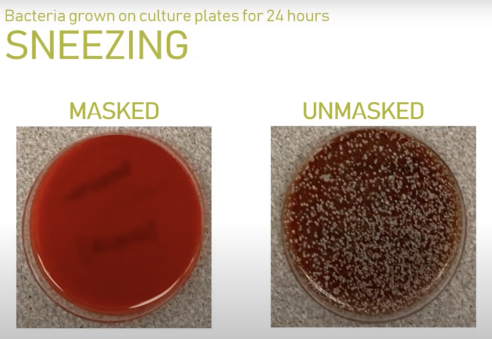 An unmasked sneezer left a huge spray of bacteria while the masked sneezer barely left a trace. Source: Microbiology Lab at Providence Sacred Heart Medical Center & Children's Hospital