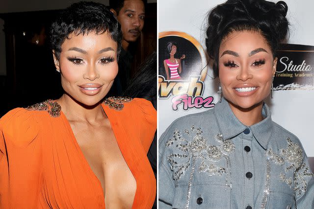 Arnold Turner/Getty, Paras Griffin/Getty Blac Chyna before and after removing her facial fillers