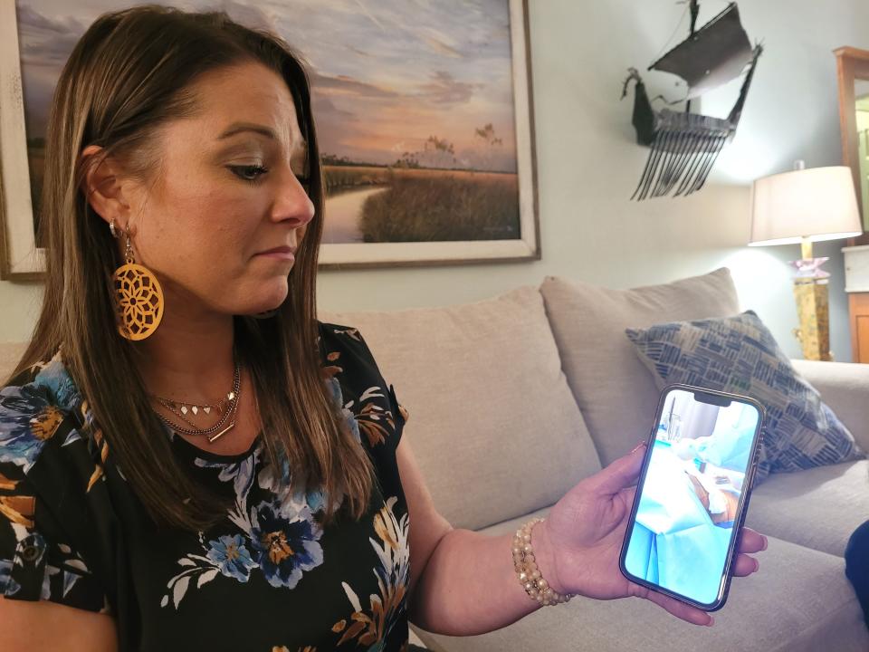 Brandi Fitzsimmons shows photos of her surgery performed by Dr. Ben Brown. The incision in her stomach opened up after the staples were removed leaving a long, deep “tunnel” in her stomach, requiring two additional surgeries.
