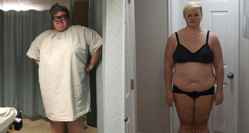 McKinnon before and during her weight-loss journey. (Photo: Madi McKinnon)