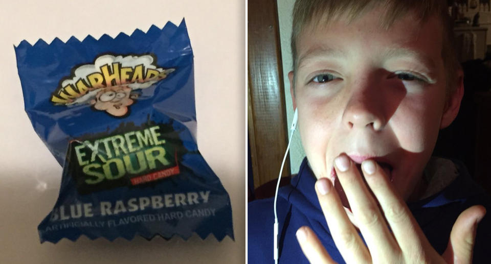 A grandmother has issued a warning after a Warhead took off the skin of her grandson's tongue.