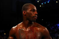 ATLANTIC CITY, NJ - APRIL 28: Chad Dawson looks on as blood drips down his chest after he was cut above his left eye by an accidental head butt from Bernard Hopkins during their WBC & Ring Magazine Light Heavyweight Title fight at Boardwalk Hall Arena on April 28, 2012 in Atlantic City, New Jersey. (Photo by Al Bello/Getty Images)