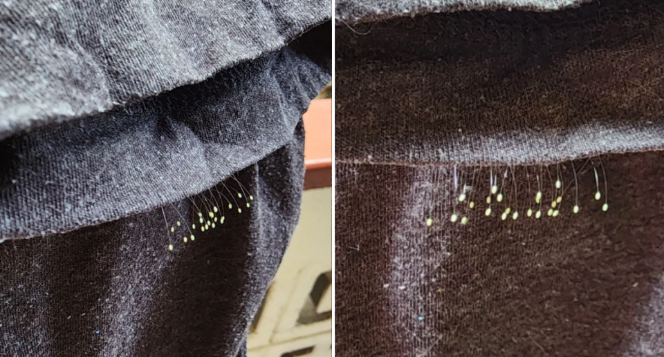 A row of lacewing eggs on a grey item of clothing.