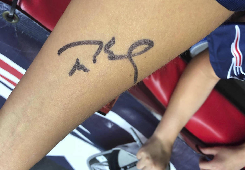 In this Monday, July 30, 2018 photo provided by Megan Uhrynowski, New England Patriots Megan Uhrynowski, 19, of Stratford, Conn., displays quarterback Tom Brady's autographs on her forearm after he signed it for her after NFL football practice at Gillette Stadium in Foxborough, Mass. Uhrynowski went to a tattoo parlor the following day and had the five-time Super Bowl champion's signature permanently etched on her arm. (Megan Uhrynowski via AP)