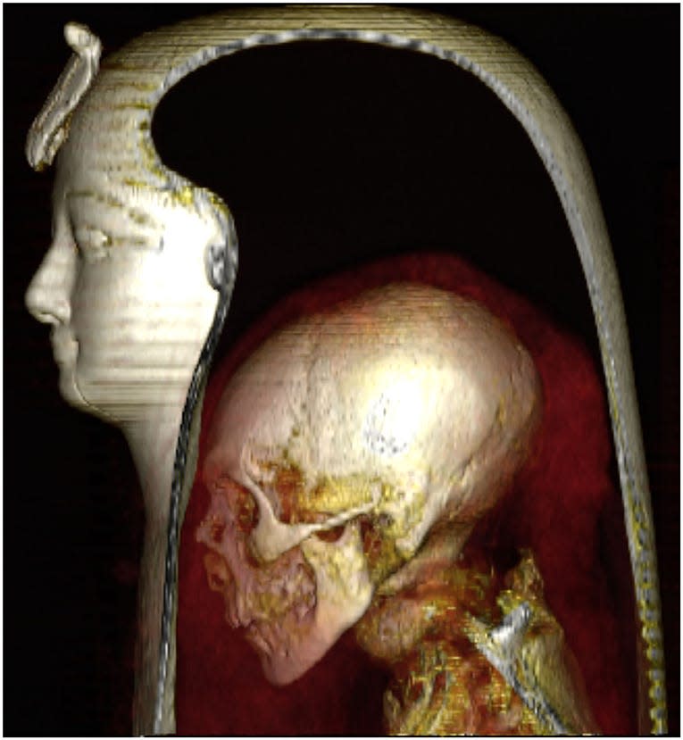 Three-dimensional CT image of the head of the wrapped mummy of Amenhotep I, showing his shrunken skull and skeleton within the bandages.