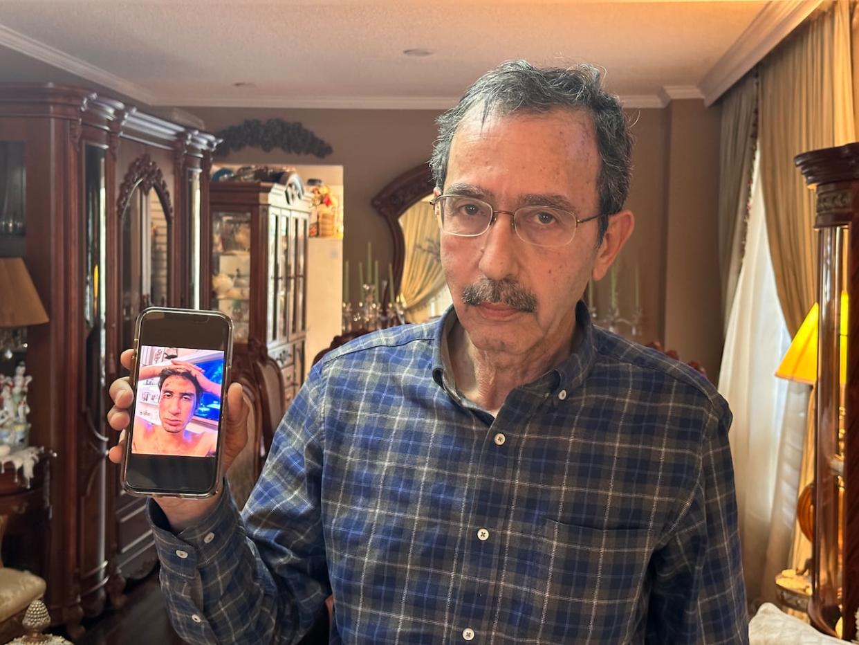 Majd Darwich holds a photo of his now 20-year-old son Abdullah from last year after he was Tasered and handcuffed by Peel police. The father says Abdullah, who is autistic and non-verbal, has become aggressive, afraid of strangers and is hard to manage at home since the incident. (Talia Ricci/CBC - image credit)