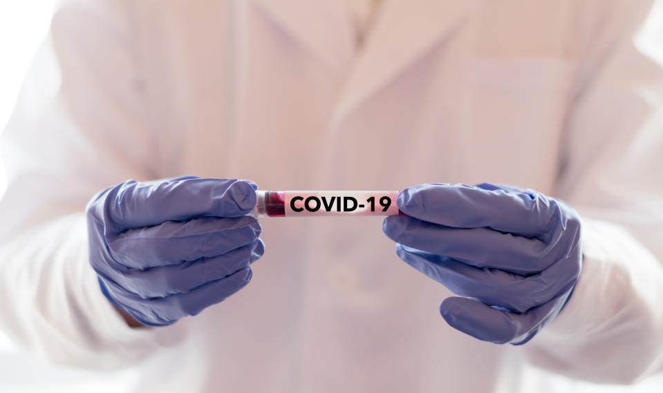 COVID-19 named by WHO for Novel coronavirus NCP concept. Doctor or lab technician holding blood sample with novel (new) coronavirus N.C.P. in Wuhan, Hubei Province, China, medical and healthcare