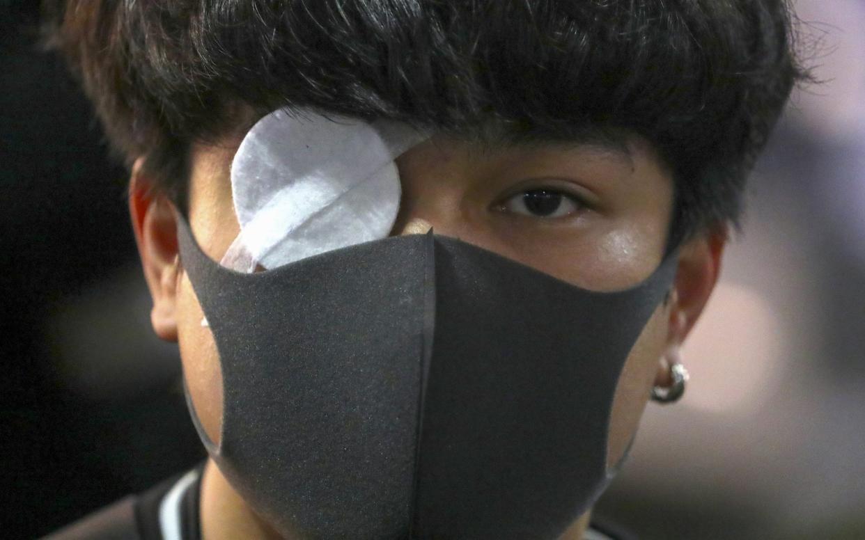 A demonstrator wears a patch over his eye during a 'Global Solidarity with Hong Kong' - Bloomberg