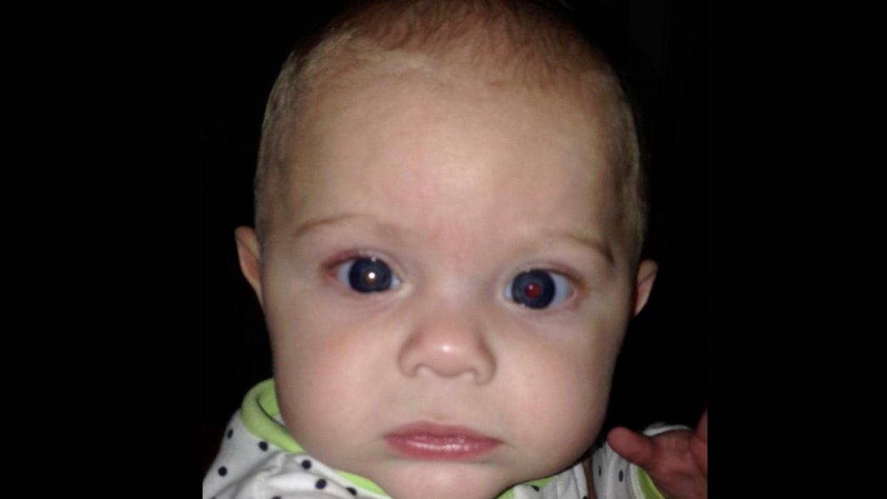 Asher’s right eye appeared different on an iPhone picture, he was later diagnosed with eye cancer (Josie Rock)