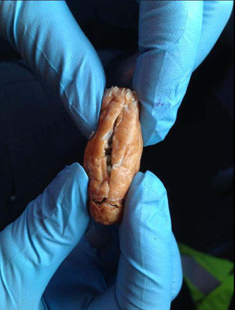 BEST QUALITY AVAILABLE Photo taken from the Twitter feed of @HailshamPolice of cocktail sausages believed to be stuffed with toxic slug pellets which were found at a popular walking spot in Hailsham, Sussex. PRESS ASSOCIATION Photo. Issue date: Thursday April 9, 2015. The sausages, which had been sliced open and filled with the blue pellets, were found on the Cuckoo Trail in Hailsham yesterday evening. See PA story POLICE Sausages. Photo credit should read: Sussex Police/PA WireNOTE TO EDITORS: This handout photo may only be used in for editorial reporting purposes for the contemporaneous illustration of events, things or the people in the image or facts mentioned in the caption. Reuse of the picture may require further permission from the copyright holder.