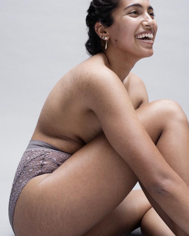 6 Women Show Off Their Stretch Marks in Striking Portraits