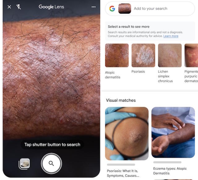google skin