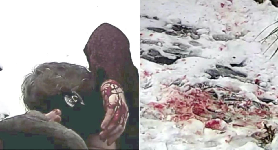 A New York City resident covered in blood pictured on the left after a squirrel attack and on the right the snow-covered ground stained with blood.