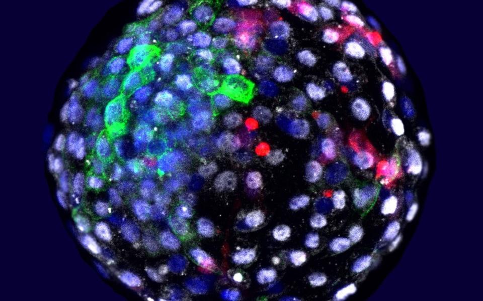 Human cells grown in an early stage monkey embryo - PA
