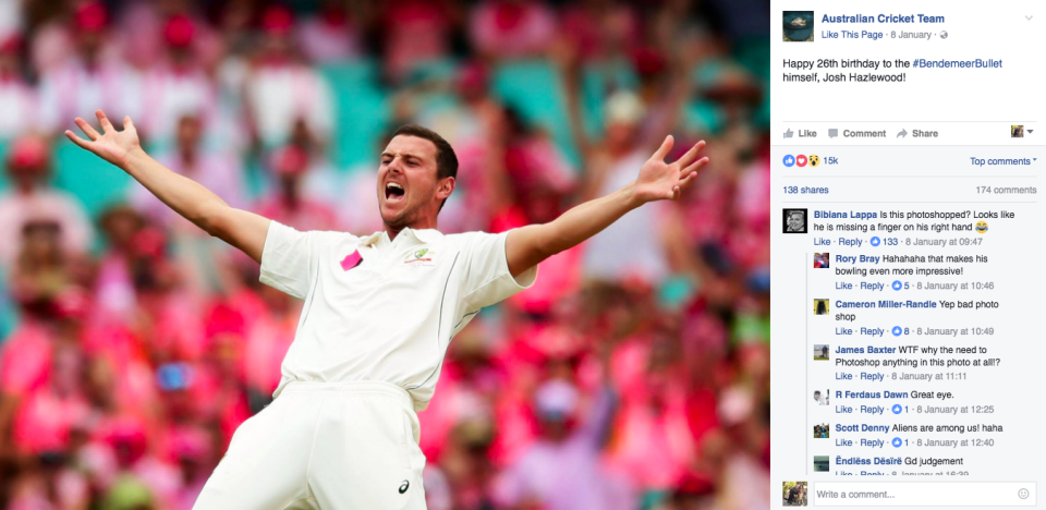 Fans immediately noticed that something was up with Hazlewood's hand. Pic: Facebook