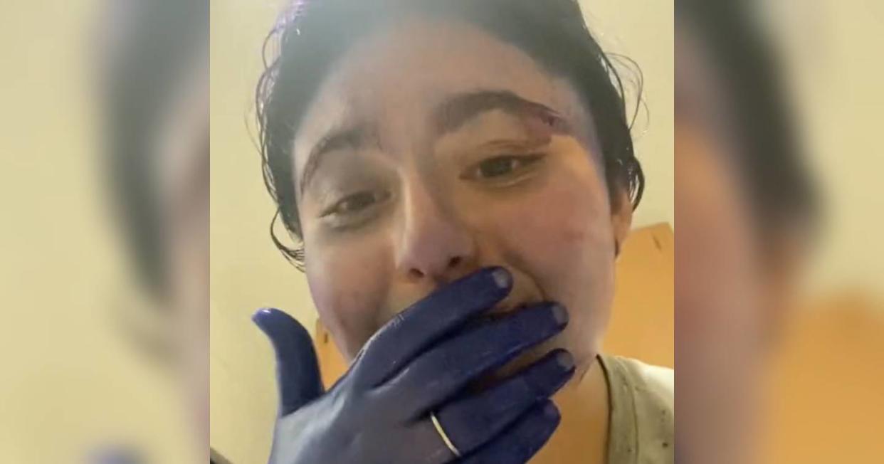 Joven se tiñe el cabello y termina con toda la cara y manos de color violeta. Foto: Captura de video 