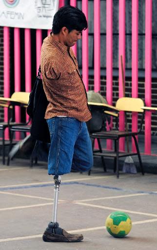 José Luis Hernández, un inmigrante hondureño discapacitado en un refugio de Ciudad de México el 9 de abril de 2014 (AFP | Alfredo Estrella)