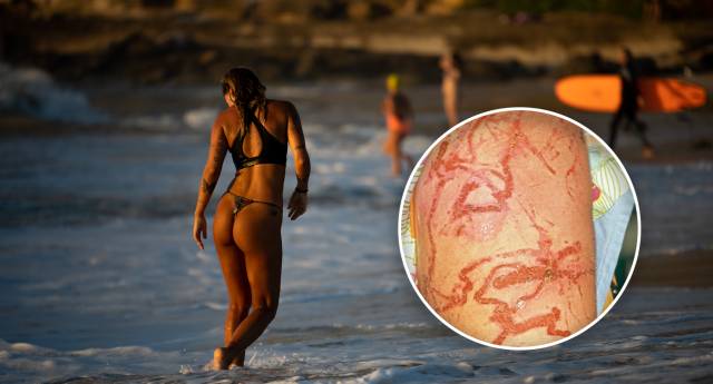Venomous stingers could trigger massive change across Aussie beaches