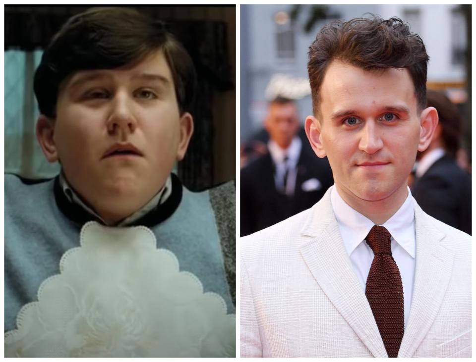 Harry Melling in Harry Potter (left) and in 2018 (Warner Bros/Rex)