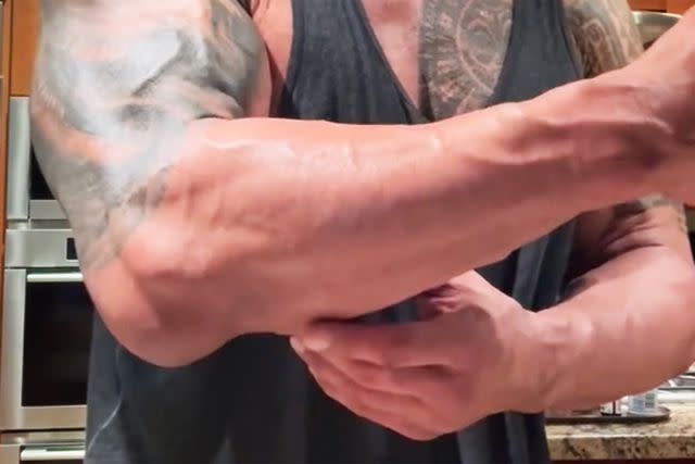 <p>Dwayne Johnson/Instagram</p> Dwayne Johnson's elbow