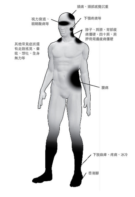 顳顎關節症候群主要的症狀