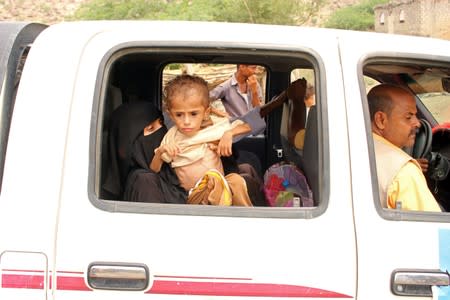 Grandmother of malnourished Muath Ali Muhammad holds him as he is being taken to a health center in Aslam district of the northwestern province of Hajja