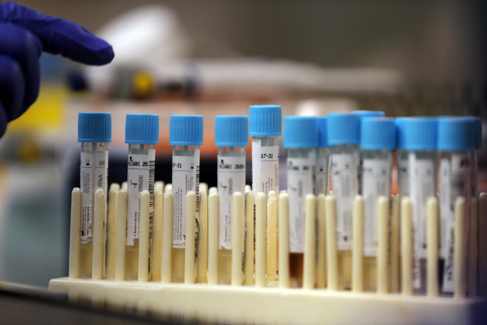 Vials with samples taken for the new coronavirus are counted before they are prepared for RNA testing at the molecular pathology lab at Tulane University School of Medicine in New Orleans, Thursday, April 2, 2020. The test is identical to the PCR test being used by the Centers for Disease Control to ease the testing crisis and stop the spread of COVID-19, which has hit the New Orleans area especially hard. (AP Photo/Gerald Herbert)