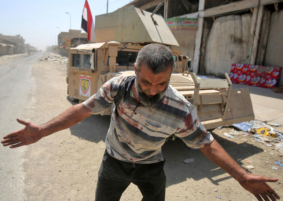 An injured Iraqi reacts