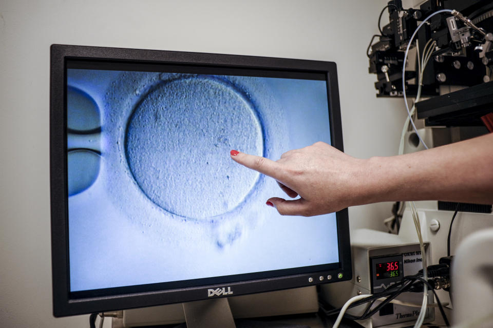 Image: An embryologist shows an ovocyte after it was inseminated at the Virginia Center for Reproductive Medicine on June 12, 2019 in Reston, Va. (Ivan Couronne / AFP via Getty Images file)