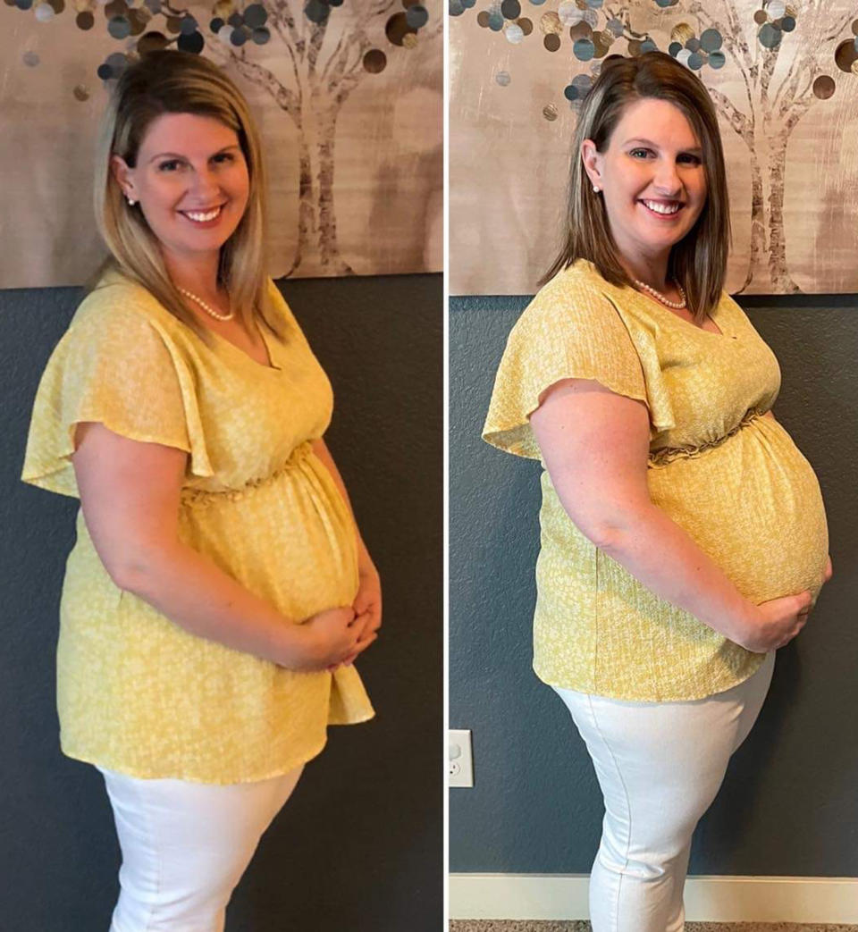 Kellee Briggs compared how she looked at 20 weeks with one baby vs. three. (Courtesy Briggs family)