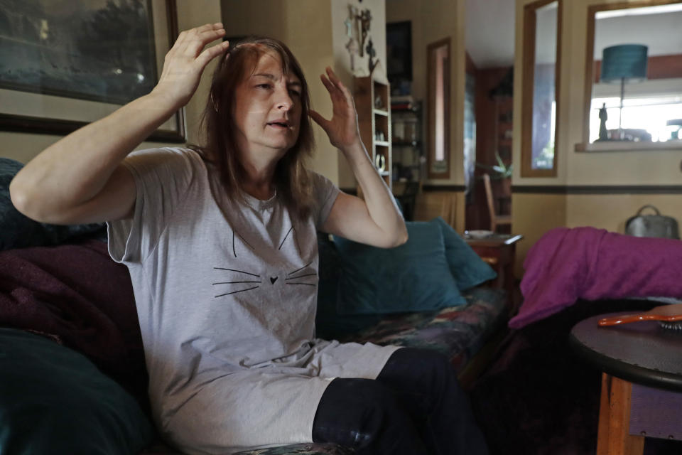 In this Feb. 10, 2020 photo, Genette Hofmann sits in her home in Burlington, Wash., and talks about her ongoing recovery a few weeks after undergoing brain surgery in Seattle in hopes of reducing the epileptic seizures that had disrupted her life for decades. At the same time, Hofmann agreed to donate a small bit of her healthy brain tissue to researchers, who were eager to study brain cells while they were still alive, joining a long line of epilepsy patients who've helped scientists reveal basic secrets of the brain. Since the operation, in addition to her scar healing, Hofmann says she has dealt with some memory and pain issues, as well as having her emotions swing widely as she continues to recover. (AP Photo/Ted S. Warren)