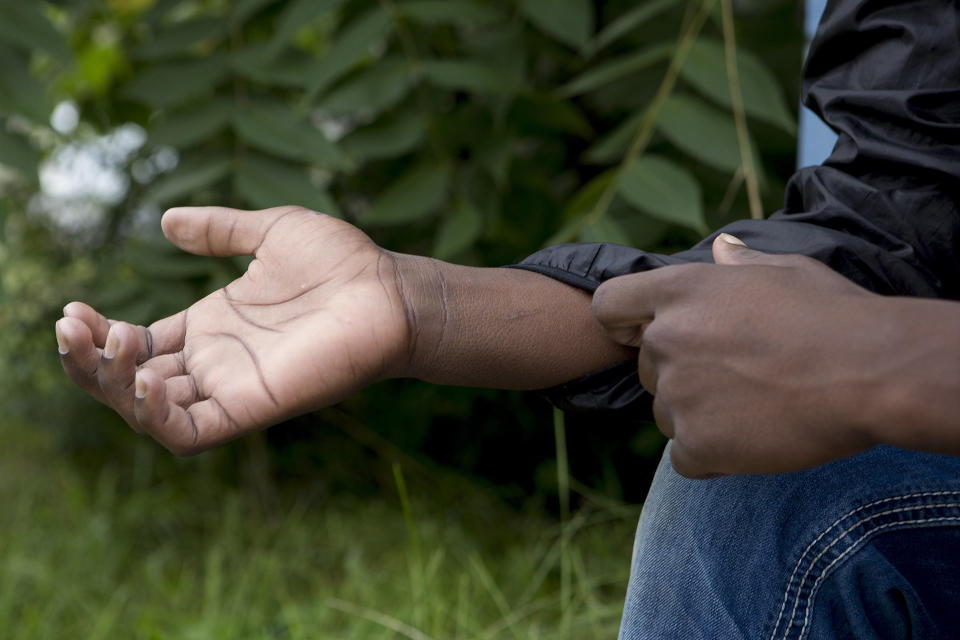 Jones talks about the cuts he received from handcuffs that have since healed as he and his mother, Tillana Jones, 38, tell the story of his incident while sitting on the front porch of their home in Kalamazoo. (Photo: Casey Sykes for HuffPost)