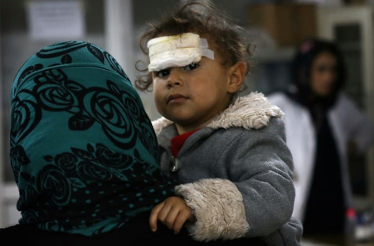 A wounded Iraqi child who was injured during the ongoing fighting between Iraqi forces and jihadists of the Islamic State group in Mosul, receives medical treatment at a hospital in Arbil on December 19, 2016