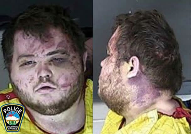 PHOTO: This booking photo provided by the Colorado Springs, Colo., Police Department shows Anderson Lee Aldrich. (Colorado Springs Police Dept. via Reuters)