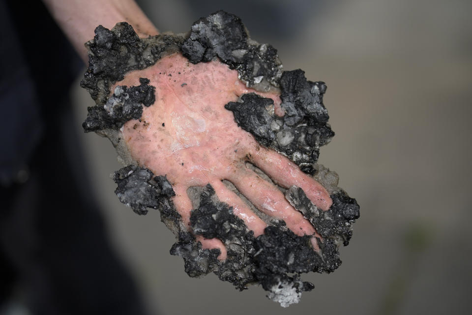 A climate activist shows his hand, covered with asphalt, after policers remove is hand with hammer and chisel from a road in Berlin, Germany, Monday, May 22, 2023. (AP Photo/Markus Schreiber)